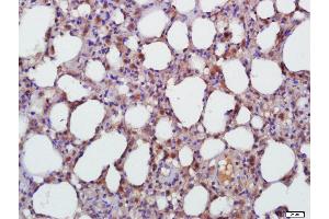 Paraformaldehyde-fixed, paraffin embedded Rat Lung Antigen retrieval by boiling in sodium citrate buffer (pH6. (TGFB1 Antikörper  (AA 351-390))