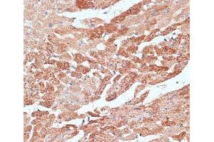 Immunohistochemistry of paraffin-embedded Mouse heart using TMX1 Polyclonal Antibody at dilution of 1:100 (40x lens). (TMX1 Antikörper)