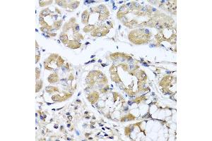 Immunohistochemistry of paraffin-embedded human stomach using IFNL1 antibody at dilution of 1:100 (40x lens). (IL29 Antikörper)