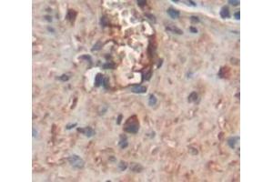IHC-P analysis of Rat Tissue, with DAB staining. (COMP Antikörper  (AA 235-423))