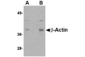 Image no. 1 for anti-Actin, beta (ACTB) (N-Term) antibody (ABIN341736) (beta Actin Antikörper  (N-Term))
