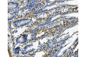 IHC analysis of MCAM using anti-MCAM antibody (ABIN7601026).