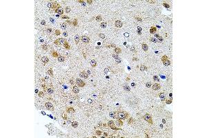 Immunohistochemistry of paraffin-embedded mouse brain using CAST antibody (ABIN3015047, ABIN3015048, ABIN5663576 and ABIN6213614) at dilution of 1:100 (40x lens). (Calpastatin Antikörper  (C-Term))