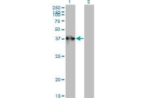 Western Blot analysis of TEX264 expression in transfected 293T cell line by TEX264 monoclonal antibody (M01), clone 2A3-1A10. (TEX264 Antikörper  (AA 1-313))