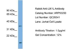 WB Suggested Anti-LIX1L  Antibody Titration: 0. (LIX1L Antikörper  (N-Term))