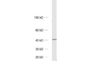 dilution: 1 : 1000, sample: rat brain homogenate (GIPC1 Antikörper)
