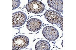 IHC analysis of SSRP1 using anti-SSRP1 antibody (ABIN7600496).