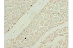 Immunohistochemistry of paraffin-embedded human heart tissue using ABIN7169525 at dilution of 1:100