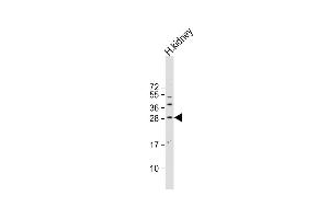 Anti-SOST Antibody (N-term) at 1:500 dilution + human kidney lysate Lysates/proteins at 20 μg per lane. (Sclerostin Antikörper  (N-Term))