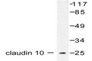 Image no. 1 for anti-Claudin 10 (CLDN10) antibody (ABIN265359) (CLDN10 Antikörper)