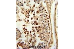 Formalin-fixed and paraffin-embedded human testis tissue reacted with P3R2 Antibody (N-term), which was peroxidase-conjugated to the secondary antibody, followed by DAB staining. (Calcineurin B Antikörper  (N-Term))