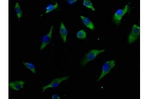 Immunofluorescence staining of U251 cells with ABIN7156793 at 1:50, counter-stained with DAPI. (IL13 Receptor alpha 1 Antikörper  (AA 22-234))