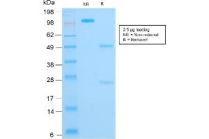 SDS-PAGE Analysis Purified Cytokeratin 16 Mouse Recombinant Monoclonal Antibody (KRT16/1714). (Rekombinanter KRT16 Antikörper  (C-Term))