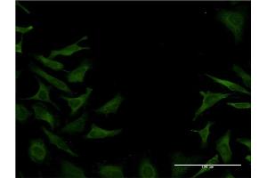 Immunofluorescence of monoclonal antibody to DST on HeLa cell. (Dystonin Antikörper  (AA 401-500))
