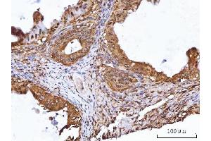 IHC analysis of TIP49A/RUVBL1 using anti-TIP49A/RUVBL1 antibody (ABIN7599928). (RUVBL1 Antikörper  (AA 13-23))