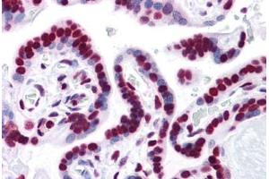Human Placenta: Formalin-Fixed, Paraffin-Embedded (FFPE) (HMGB1 Antikörper  (AA 1-216))