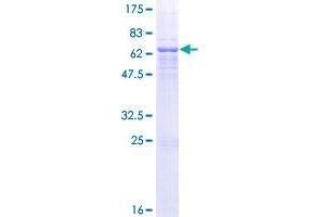 Image no. 1 for Glutaminyl-Peptide Cyclotransferase (QPCT) (AA 1-361) protein (GST tag) (ABIN1317000) (QPCT Protein (AA 1-361) (GST tag))