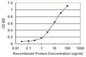 Detection limit for recombinant GST tagged RAB7B is 0. (RAB7B Antikörper  (AA 100-199))