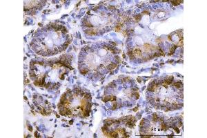 IHC analysis of RPL36 using anti-RPL36 antibody (ABIN7602917). (RPL36 Antikörper  (C-Term))