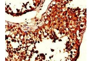 Immunohistochemistry of paraffin-embedded human testis tissue using ABIN7169181 at dilution of 1:100 (SIK1 Antikörper  (AA 492-750))