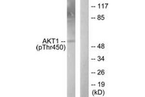 Western blot analysis of extracts from NIH-3T3 cells treated with PDGF 50ng/ml 20', using Akt1 (Phospho-Thr450) Antibody.