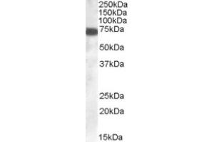 Image no. 1 for anti-Zinc Finger, DHHC-Type Containing 13 (ZDHHC13) (C-Term) antibody (ABIN374518) (ZDHHC13 Antikörper  (C-Term))