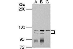 WB Image Sample (30 ug of whole cell lysate) A: Jurkat B: Raji C: K562 5% SDS PAGE antibody diluted at 1:2000 (ATP2A3 Antikörper  (N-Term))