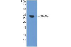 Western blot analysis of the recombinant protein. (SIRT1 Antikörper  (AA 238-482))
