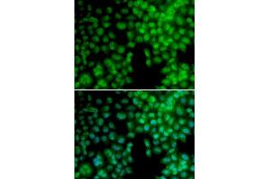 Immunofluorescence analysis of A549 cell using VDR antibody. (Vitamin D Receptor Antikörper  (AA 1-300))
