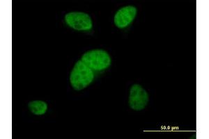 Immunofluorescence of purified MaxPab antibody to ARS2 on HeLa cell.