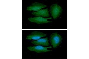 ICC/IF analysis of BRCC36 in HeLa cells line, stained with DAPI (Blue) for nucleus staining and monoclonal anti-human BRCC36 antibody (1:100) with goat anti-mouse IgG-Alexa fluor 488 conjugate (Green). (BRCC3 Antikörper  (AA 1-316))