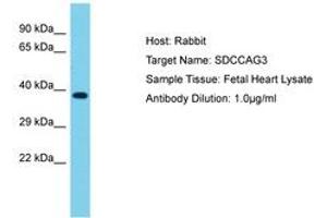 Image no. 1 for anti-serologically Defined Colon Cancer Antigen 3 (SDCCAG3) (AA 221-270) antibody (ABIN6750584) (SDCCAG3 Antikörper  (AA 221-270))