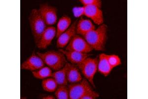 IF analysis of BCKDK using anti-BCKDK antibody (ABIN7601470). (BCKDK Antikörper  (AA 36-316))