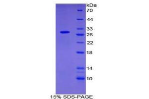 SDS-PAGE analysis of Human OIT3 Protein.