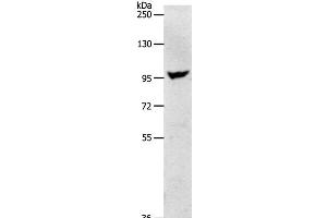 Western Blot analysis of Human fetal brain tissue using NFATC2 Polyclonal Antibody at dilution of 1:650