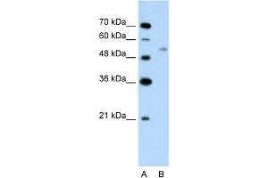 WB Suggested Anti-C14orf130 Antibody Titration:  2. (UBR7 Antikörper  (Middle Region))