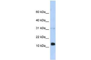 WB Suggested Anti-REG1B Antibody Titration:  0. (REG1B Antikörper  (N-Term))