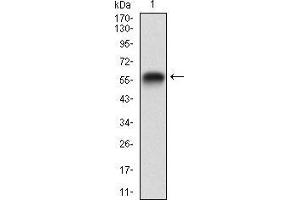 Western blot analysis using RAP1GAP mAb against human RAP1GAP (AA: 412-678) recombinant protein.