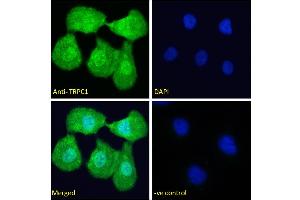 ABIN6391351 Immunofluorescence analysis of paraformaldehyde fixed U2OS cells, permeabilized with 0.