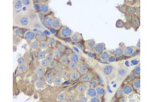 Immunohistochemistry analysis of paraffin-embedded mouse testis using FAS Monoclonal Antibody at dilution of 1:200.