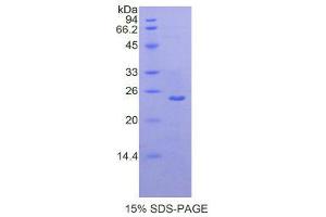 SDS-PAGE (SDS) image for Matrix Metallopeptidase 13 (Collagenase 3) (MMP13) (AA 290-468) protein (His tag) (ABIN2121606)