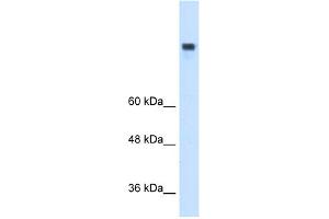 WB Suggested Anti-MTTP Antibody Titration:  0. (MTTP Antikörper  (N-Term))