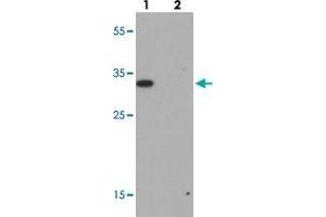 Western blot analysis of RILP in A-20 cell lysate with RILP polyclonal antibody  at 1 ug/mL.