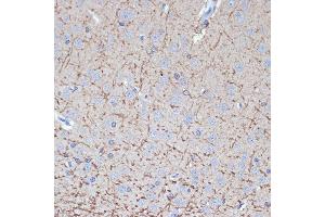 Immunohistochemistry of paraffin-embedded rat brain using TMOD2 Rabbit mAb (ABIN7271011) at dilution of 1:100 (40x lens). (TMOD2 Antikörper)