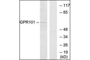 Western blot analysis of extracts from COS7 cells, using GPR101 Antibody. (GPR101 Antikörper  (C-Term))