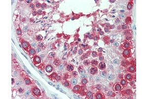 Anti-TCP1 antibody IHC staining of human testis. (TCP1 alpha/CCTA Antikörper  (AA 1-557))