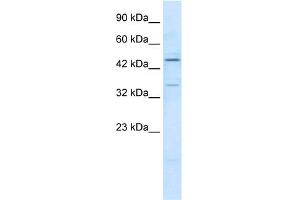 WB Suggested Anti-ZNF358 Antibody Titration:  1. (ZNF358 Antikörper  (N-Term))