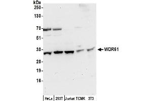 anti-WD Repeat Domain 61 (WDR61) (AA 50-100) antibody