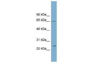 WB Suggested Anti-RPN2 Antibody Titration:  0.