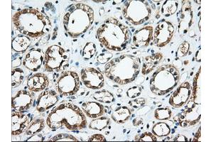 Immunohistochemical staining of paraffin-embedded Human Kidney tissue using anti-KHK mouse monoclonal antibody. (Ketohexokinase Antikörper)